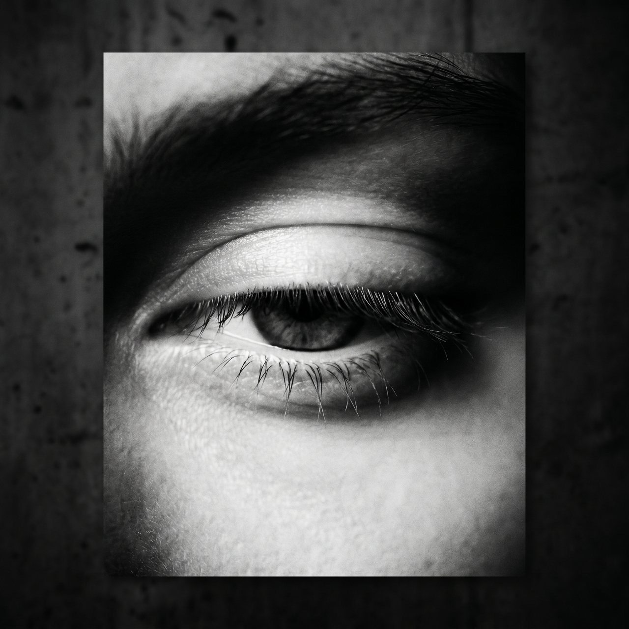 Blefaroplastia